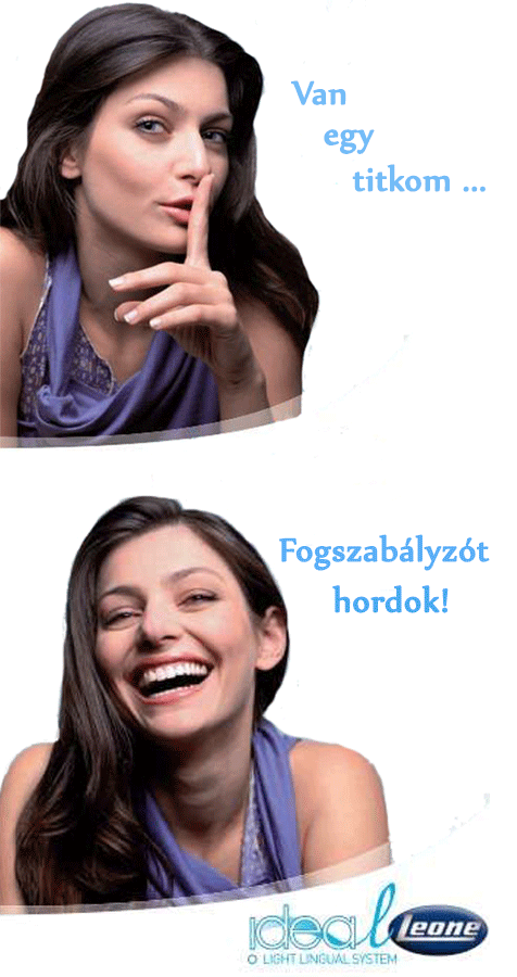 Ideal - Leone - Láthatatlan fogszabályozó készülék